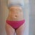 6 days post op