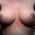4 Weeks post op