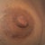 close up of scar