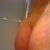 4 days post op