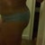 5 weeks post op (side view)belly still swollen 750 cc's were injected on 3/24/11