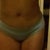 5 weeks post op (front view)