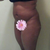 8/27/12 - Pre Op
