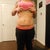 3 weeks(ish) pre-op, front view.