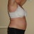 20 Day Post Op