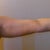 Arm
