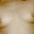 Before Implants 8 years ago
