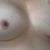 With Implants
