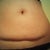 Close up of Tummy