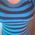 7 Weeks Post Op