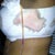 Got quite bloody- 1 day post op