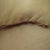 04/19/13-2 weeks-left side scar close up
