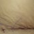 04/19/13-2 weeks-right side scar close up