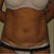 before pic