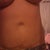 Close up of stomach after 20 lb gain