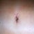 BB 4 weeks PO