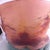 Day 5 PO. My flank/lower back bruising (from lipo) is changing colors - seeing more green/yellow on flank area and more black/blue on lower back area.