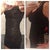 Left: Before surgery and flat, flat, flat. Right: 16 weeks post op with a pooch in the same dress. The pointy protrusion is the ridge of my scar