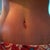 tummy in bathing suit - 2 weeks post op
