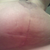 underside 3wks