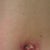 P.O. Day 18 - Belly Button Close Up