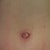 P.O. Day 18 - Belly Button