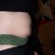 3 weeks before surgery