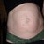 3 weeks before surgery
