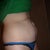 Tummy- side view 6 days pre op