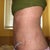 5 weeks... left side more swollen than right side