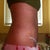 5 weeks... right side