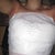 All bandaged up, bleeding coming from right nipple yesterday, today there is more fluid leaking around towards the side of the right boob