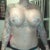 1 weeks post op