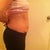 Side view.  Day before surgery