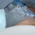 Love handles treated with the small filter