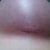 scar 7 weeks