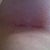 scar 7 weeks