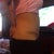 Two month post op... side view!