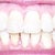 12-19-2012 Mouth closed