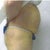 2/15/2012  174 lb.  Before any procedures.