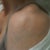 Tattoo removal, about 6 sessions