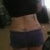 8 weeks po still swollen