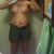 2 wks post op