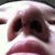 Nostrils are very uneven due to swelling but I don't really care