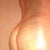 5 day post op