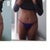 PO 21 - I hope this turns out, but this is me side by side with my pre-op undies.   I can't pinpoint exactly what the difference is in my silhouette.  It looks like my torso is shorter, I think maybe it's that my BB is lower somehow and also I'm still a little hunched.  He got pretty right on, although I do have to raise the sides a little to cover the scar.  My scar will still hide nicely under the lowest bikini I would probably ever wear!