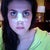 4 days after surgery (December 19th) more yellow under eyes