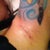 Incision