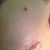 Incision, I think this one looks like a vagina lol