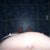 Day 40 - 5 and half wks - bulge still there to the right, breathing out